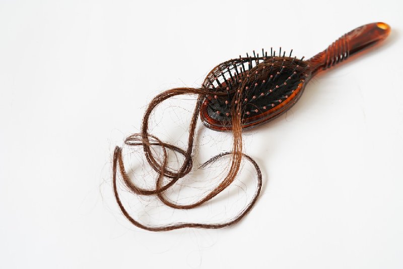 Jakie są przyczyny łysienia?